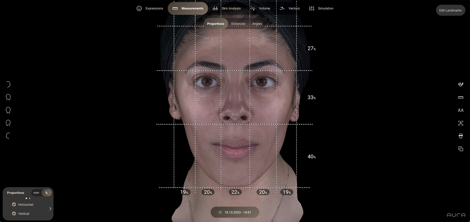 Aura measurements view: 63 facial landmarks mapped in golden thirds and fifths