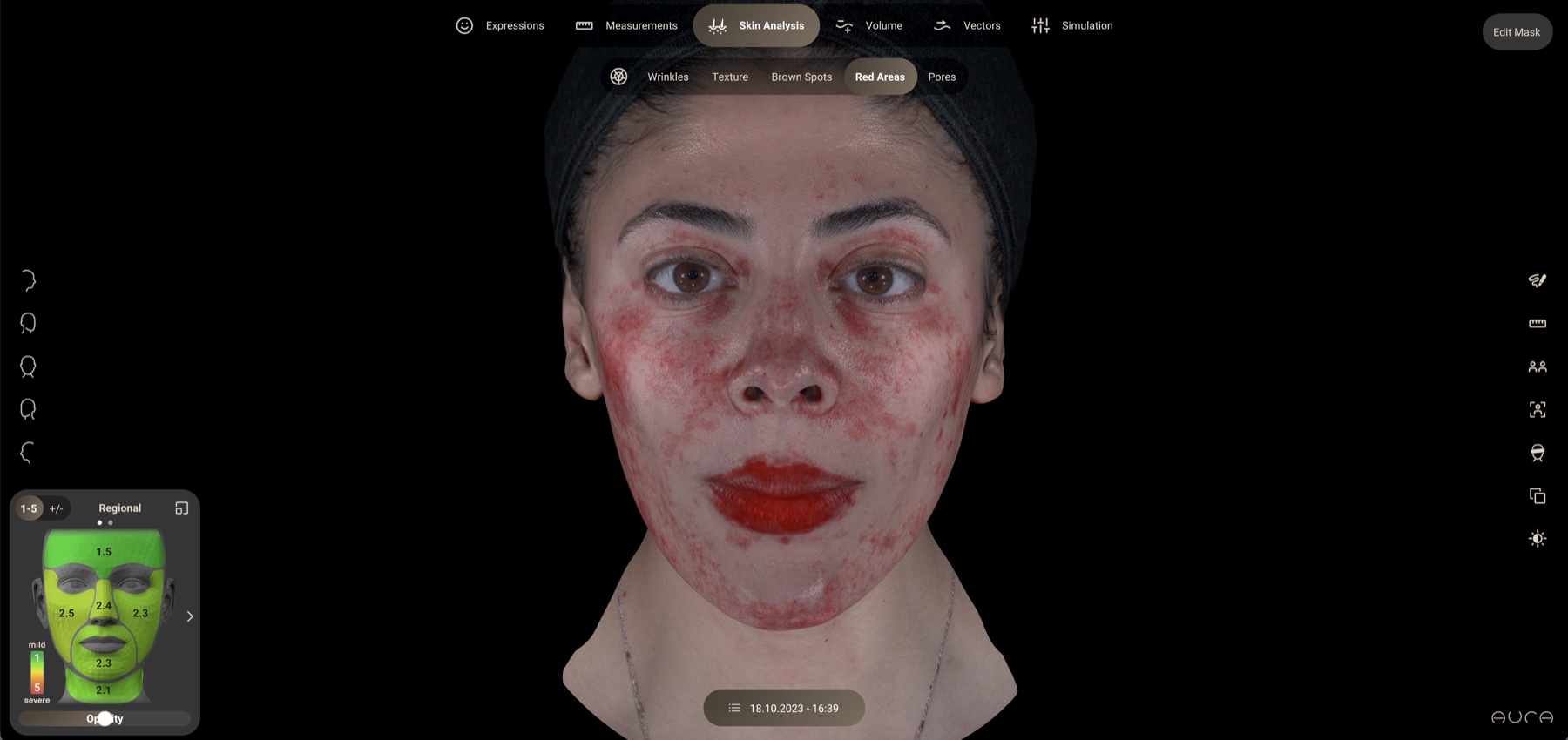 Aura red areas analysis: subsurface redness highlighted across the face